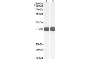 ABIN190828 (0. (Liver Arginase Antikörper  (C-Term))