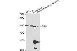 Western blot analysis of extracts of various cell lines, using CUL5 Antibody.