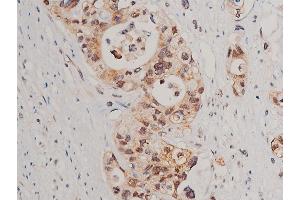 Immunohistochemistry (IHC) image for anti-Caspase 3 (CASP3) (pSer150) antibody (ABIN6254994)
