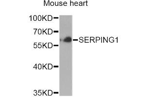 Western blot analysis of extracts of mouse heart, using SERPING1 Antibody (ABIN6290125) at 1:1000 dilution. (SERPING1 Antikörper)