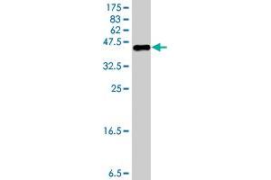 Western Blot detection against Immunogen (36. (CRLF1 Antikörper  (AA 135-230))