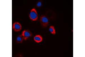 Immunofluorescent analysis of EGFR staining in HeLa cells. (EGFR Antikörper  (Center))