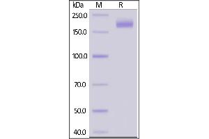 SARS-CoV-2 S protein (D614G), His Tag, Super stable trimer on SDS-PAGE under reducing (R) condition. (SARS-CoV-2 Spike Protein (D614G, Super Stable Trimer) (His tag))