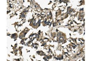 IHC analysis of IL3RA using anti-IL3RA antibody (ABIN7599742). (IL3RA Antikörper  (AA 111-378))