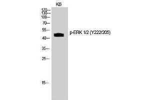 Western Blotting (WB) image for anti-Mitogen-Activated Protein Kinase 1/3 (MAPK1/3) (pTyr205), (pTyr222) antibody (ABIN3173143) (ERK1/2 Antikörper  (pTyr205, pTyr222))