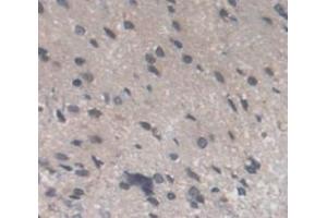 IHC-P analysis of Kidney tissue, with DAB staining. (Recoverin Antikörper  (AA 2-200))