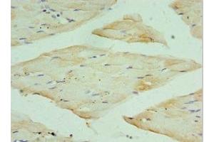 Immunohistochemistry of paraffin-embedded human skeletal muscle tissue using ABIN7167692 at dilution of 1:100