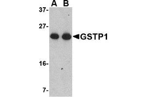 Western Blotting (WB) image for anti-Glutathione S-Transferase pi 1 (GSTP1) (Middle Region) antibody (ABIN1030946)