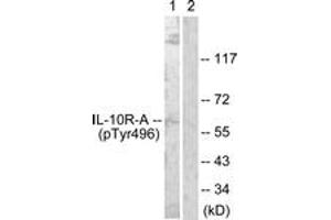 Western blot analysis of extracts from HuvEc cells, using IL-10R alpha (Phospho-Tyr496) Antibody. (IL-10RA Antikörper  (pTyr496))