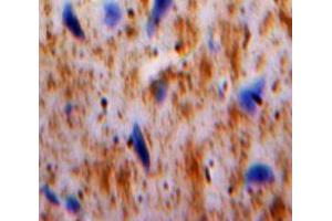 Used in DAB staining on fromalin fixed paraffin-embedded Brain tissue (PLAUR Antikörper  (AA 123-216))