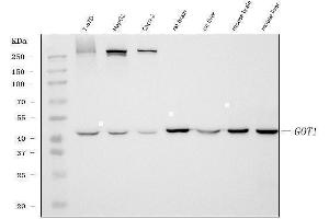 Western blot analysis of Aspartate Aminotransferase/GOT1 using anti-Aspartate Aminotransferase/GOT1 antibody (ABIN7601883).