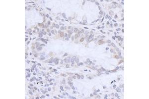 anti-High Mobility Group Nucleosomal Binding Domain 3 (HMGN3) (AA 30-60) antibody