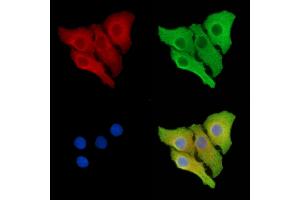 ABIN6264421 and ABIN6278673 staining Hela cells by IF/ICC. (PRKAB2 Antikörper  (N-Term))