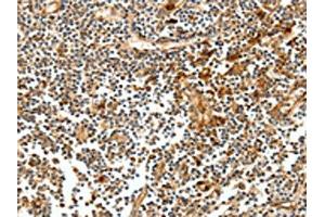 The image on the left is immunohistochemistry of paraffin-embedded Human tonsil tissue using ABIN7128894(CEACAM21 Antibody) at dilution 1/60, on the right is treated with fusion protein. (CEACAM21 Antikörper)