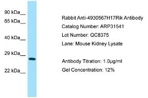 WB Suggested Anti-4930567H17Rik Antibody   Titration: 1.