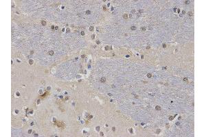 Immunohistochemistry (IHC) image for anti-Calcium/calmodulin-Dependent serine Protein Kinase (MAGUK Family) (CASK) antibody (ABIN1871447) (CASK Antikörper)