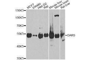 Western blot analysis of extracts of various cell lines, using DARS Antibody. (DARS Antikörper  (AA 222-501))