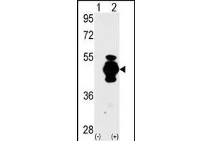 Western blot analysis of GF (arrow) using GF Antibody (N-term) 2017a. (GFAP Antikörper  (N-Term))