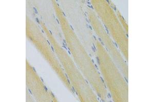 Immunohistochemistry of paraffin-embedded mouse skeletal muscle using CXCR3 Antibody. (CXCR3 Antikörper)