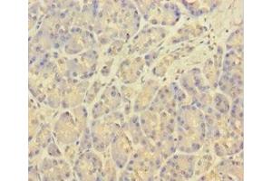 Immunohistochemistry of paraffin-embedded human pancreatic tissue using ABIN7146334 at dilution of 1:100 (KCNMA1 Antikörper  (AA 1-86))