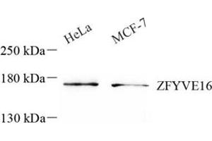 Western blot analysis of ZFYVE16 (ABIN7076283) at dilution of 1: 500 (ZFYVE16 Antikörper)