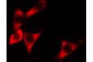 ABIN6274275 staining HeLa cells by IF/ICC. (BCAP31 Antikörper  (C-Term))