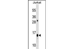 ATP5D Antibody (C-term) (ABIN1536694 and ABIN2848523) western blot analysis in Jurkat cell line lysates (35 μg/lane). (ATP5F1D Antikörper  (C-Term))