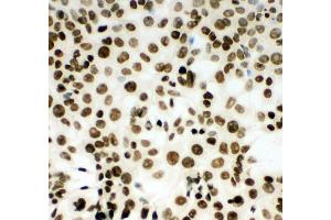 Anti-MCM2 antibody, ICC ICC: HEPA Cell