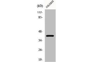 Western Blot analysis of COLO205 cells using GPR62 Polyclonal Antibody