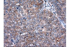 Immunohistochemical staining of paraffin-embedded Human Kidney tissue using anti-ACAT2 mouse monoclonal antibody. (ACAT2 Antikörper)