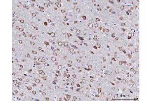 IHC analysis of BBS9 using anti-BBS9 antibody (ABIN7601518). (BBS9 Antikörper  (AA 37-793))