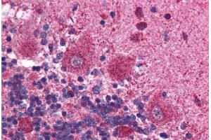 Human Brain, Cerebellum (formalin-fixed, paraffin-embedded) stained with MAPK14 antibody ABIN214794 at 2. (MAPK14 Antikörper  (C-Term))