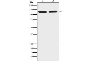 Western blot analysis of Chromogranin B expression in (1) HeLa cell lysate, (2) Raw 264.