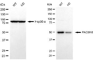 Western blotting analysis using PACSIN3 antibody (ABIN7799982). (PACSIN3 Antikörper)