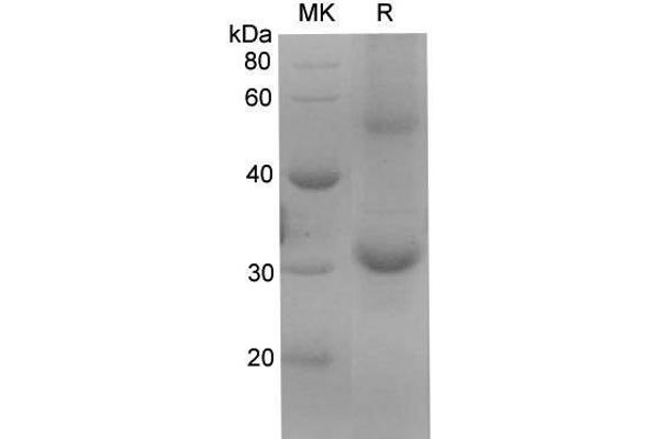 Kallikrein 6 Protein (KLK6) (His tag)