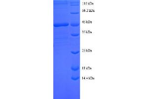 Sorting Nexin 3 (SNX3) (AA 3-162), (full length) protein (GST tag)
