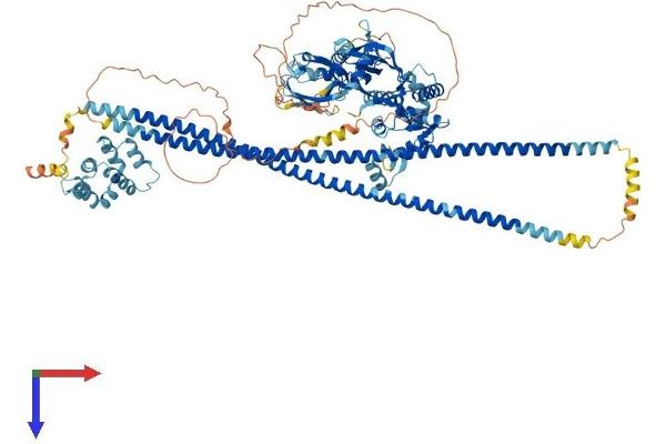 CARD14 Protein (AA 1-999) (His tag)