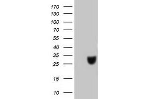 Western Blotting (WB) image for anti-Chromosome 20 Open Reading Frame 43 (C20orf43) antibody (ABIN1497038) (C20orf43 Antikörper)