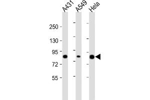 All lanes : Anti-PLA2G4D Antibody (C-Term) at 1:2000 dilution Lane 1: A431 whole cell lysate Lane 2: A549 whole cell lysate Lane 3: Hela whole cell lysate Lysates/proteins at 20 μg per lane. (PLA2G4D Antikörper  (AA 754-786))