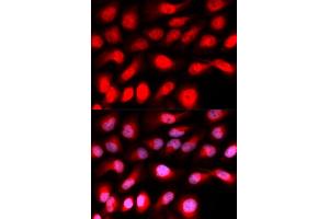 Immunofluorescence analysis of U2OS cells using ZEB1 antibody (ABIN5973261). (ZEB1 Antikörper)