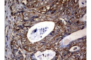 Image no. 3 for anti-3-Oxoacyl-ACP Synthase, Mitochondrial (OXSM) (AA 78-343) antibody (ABIN1491676) (OXSM Antikörper  (AA 78-343))