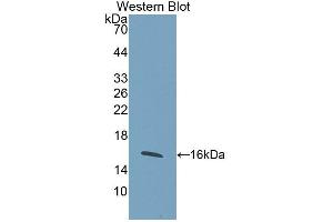 Western blot analysis of the recombinant protein. (WISP1 Antikörper  (AA 216-347))