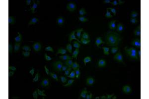 Immunofluorescence staining of A549 cells with ABIN7148235 at 1:100, counter-stained with DAPI. (COL18A1 Antikörper  (AA 1600-1754))