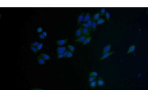 Detection of FAS in Human MCF7 cell using Polyclonal Antibody to Factor Related Apoptosis (FAS)