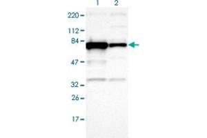 Western blot analysis of Lane 1: Human cell line RT-4 Lane 2: Human cell line U-251MG sp with OPTN polyclonal antibody  at 1:100-1:250 dilution.