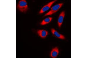 Immunofluorescent analysis of TRAF3IP1 staining in HeLa cells.