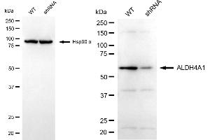 Western blotting analysis using ALDH4A1 antibody (ABIN7797566). (ALDH4A1 Antikörper)