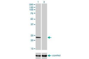 Western blot analysis of RAB9A over-expressed 293 cell line, cotransfected with RAB9A Validated Chimera RNAi (Lane 2) or non-transfected control (Lane 1). (RAB9A Antikörper  (AA 17-115))