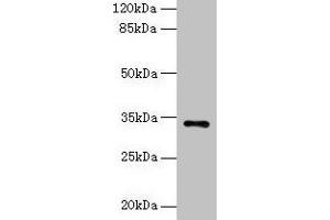 Western blot All lanes: NAT2 antibody at 6 μg/mL + Mouse brain tissue Secondary Goat polyclonal to rabbit IgG at 1/10000 dilution Predicted band size: 34 kDa Observed band size: 34 kDa (NAT2 Antikörper  (AA 1-290))