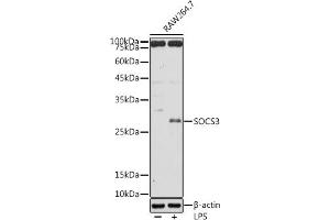 Western blot analysis of extracts of R. (SOCS3 Antikörper  (C-Term))